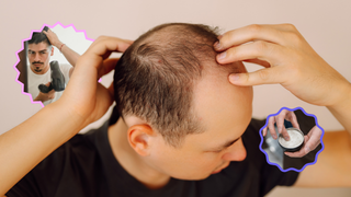 5 Kebiasaan Cowok Penyebab Rambut Rontok dan Cara Mengatasinya