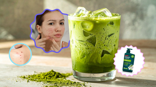 Matcha Girlies Wajib Tahu, Minuman Ini Ternyata Punya Manfaat Buat Kulit Berjerawat