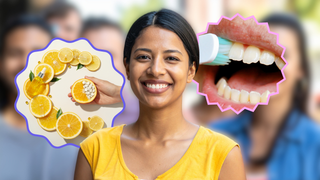 Dari Skincare ke Oral Care? Ini Fakta tentang Vitamin A, C,  dan E untuk Kesehatan Gigi dan Mulut